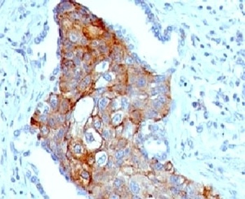 TRIM29 Antibody