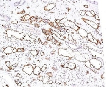 C4A & C4B Antibody