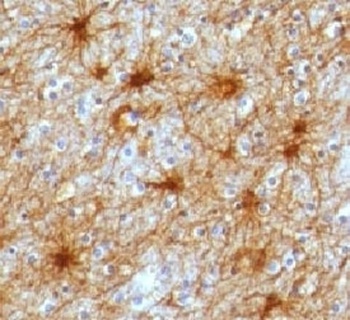 GFAP Antibody