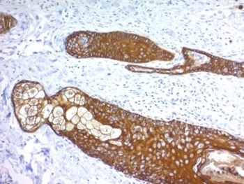 KRT76 Antibody