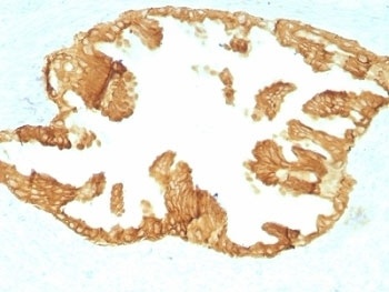 KRT76 Antibody
