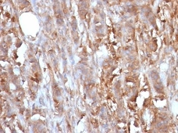 B2M Antibody