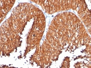 HSPD1 Antibody