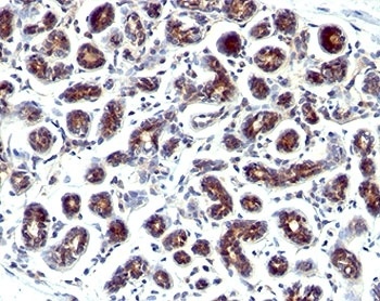 TFF1 Antibody