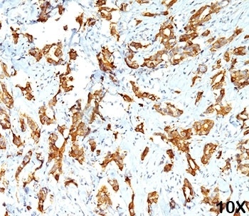 HSPB1 Antibody