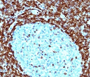 BCL2 Antibody