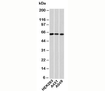 HSPD1 Antibody