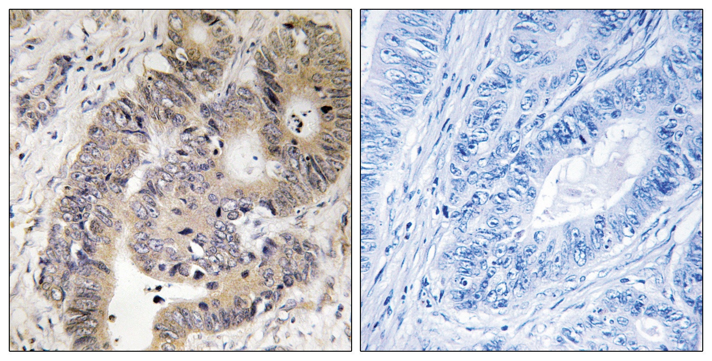 CAD Antibody