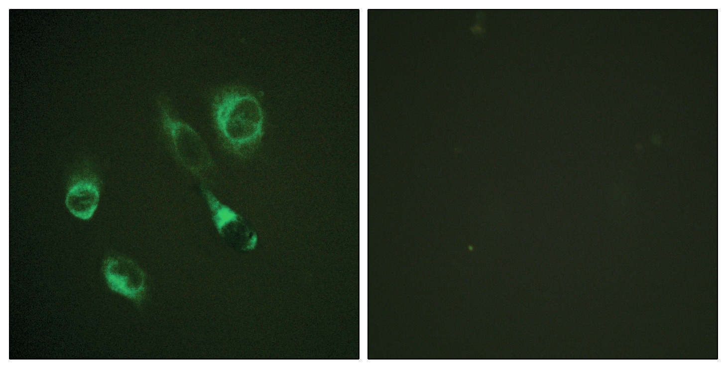 EPHA2, EPHA3, EPHA4 Antibody