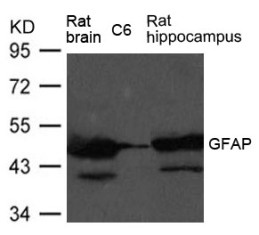 GFAP Antibody