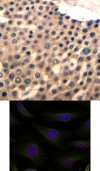 HDAC4 HDAC5 HDAC9 Antibody