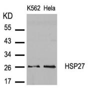 HSPB1 Antibody