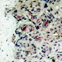JAK1 Antibody