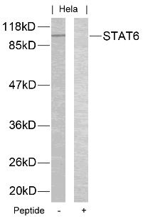 STAT6 Antibody