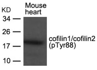 CFL1 CFL2 Antibody