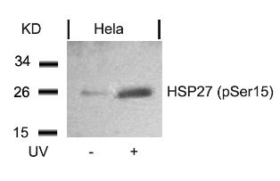 HSPB1 Antibody