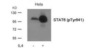 STAT6 Antibody