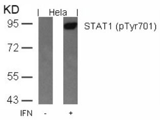 STAT1 Antibody