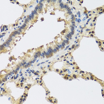 IL25 Antibody