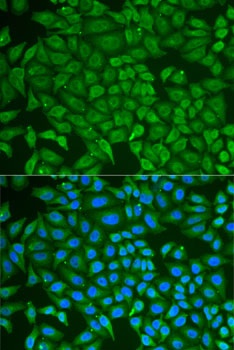 PIP Antibody