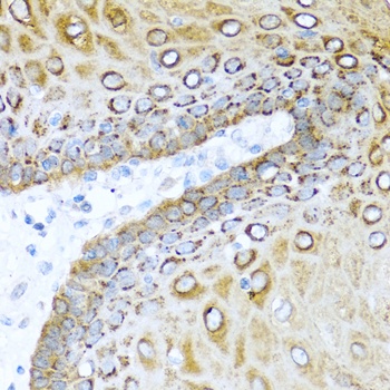 S100A7 Antibody