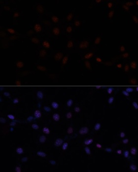 MKI67 Antibody