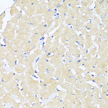 TGFB2 Antibody