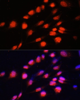 ZNF574 Antibody