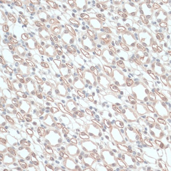ZNF416 Antibody