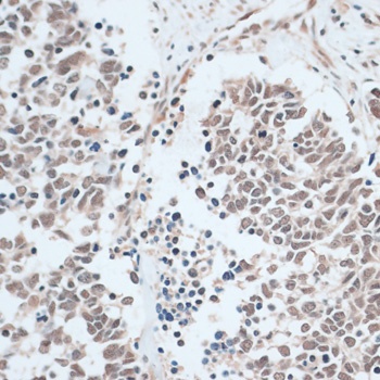 ZNF416 Antibody
