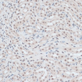 ZNF416 Antibody