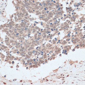 ZNF562 Antibody