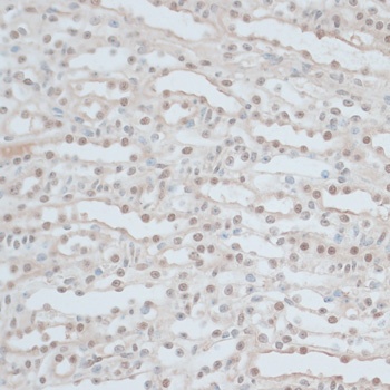 ZNF562 Antibody
