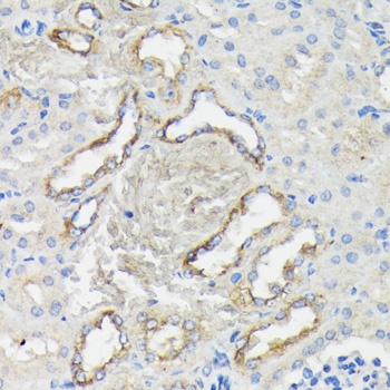 KRT7 Antibody