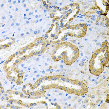 ABL1 Antibody