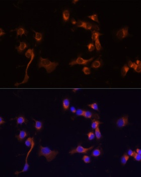ABL1 Antibody