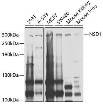 NSD1 Antibody