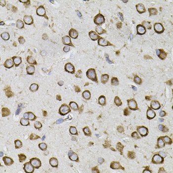 CEP164 Antibody