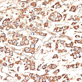 KIR3DS1 Antibody