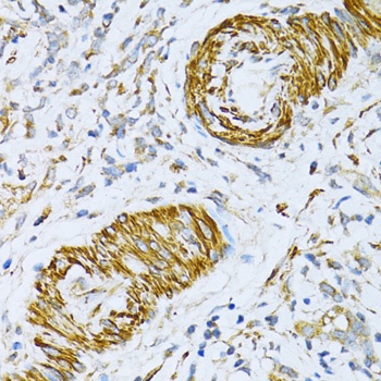 VAMP1 Antibody