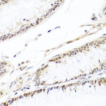 HIRA Antibody