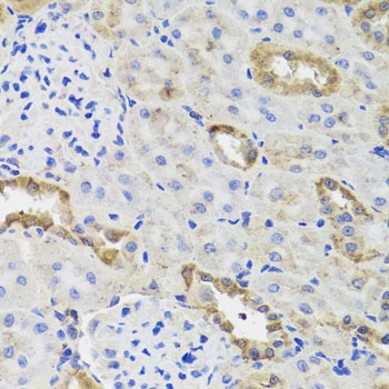 HK3 Antibody