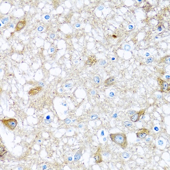 BMP5 Antibody