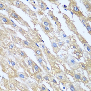 PPP4R1 Antibody