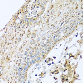 NDUFA2 Antibody