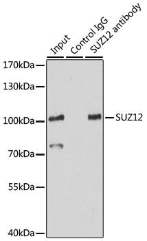 ADAR Antibody