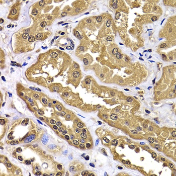WBSCR22 Antibody