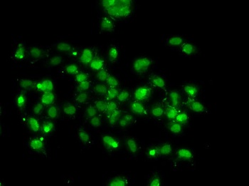 WBSCR22 Antibody