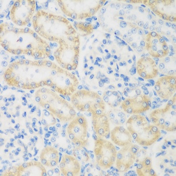NAT8B Antibody