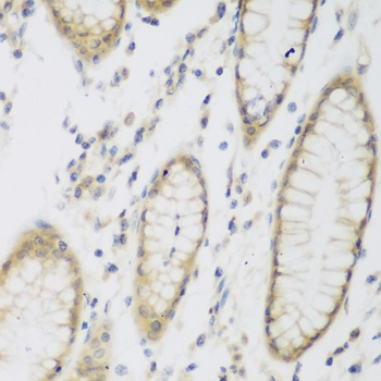 NAT8B Antibody